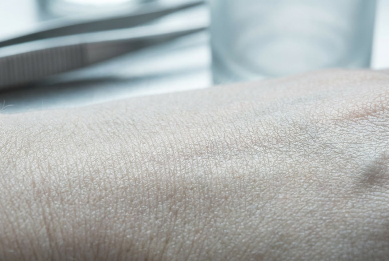 Texture cutanea ravvicinata — microbioma e barriera della pelle, Remodermis skincare medica