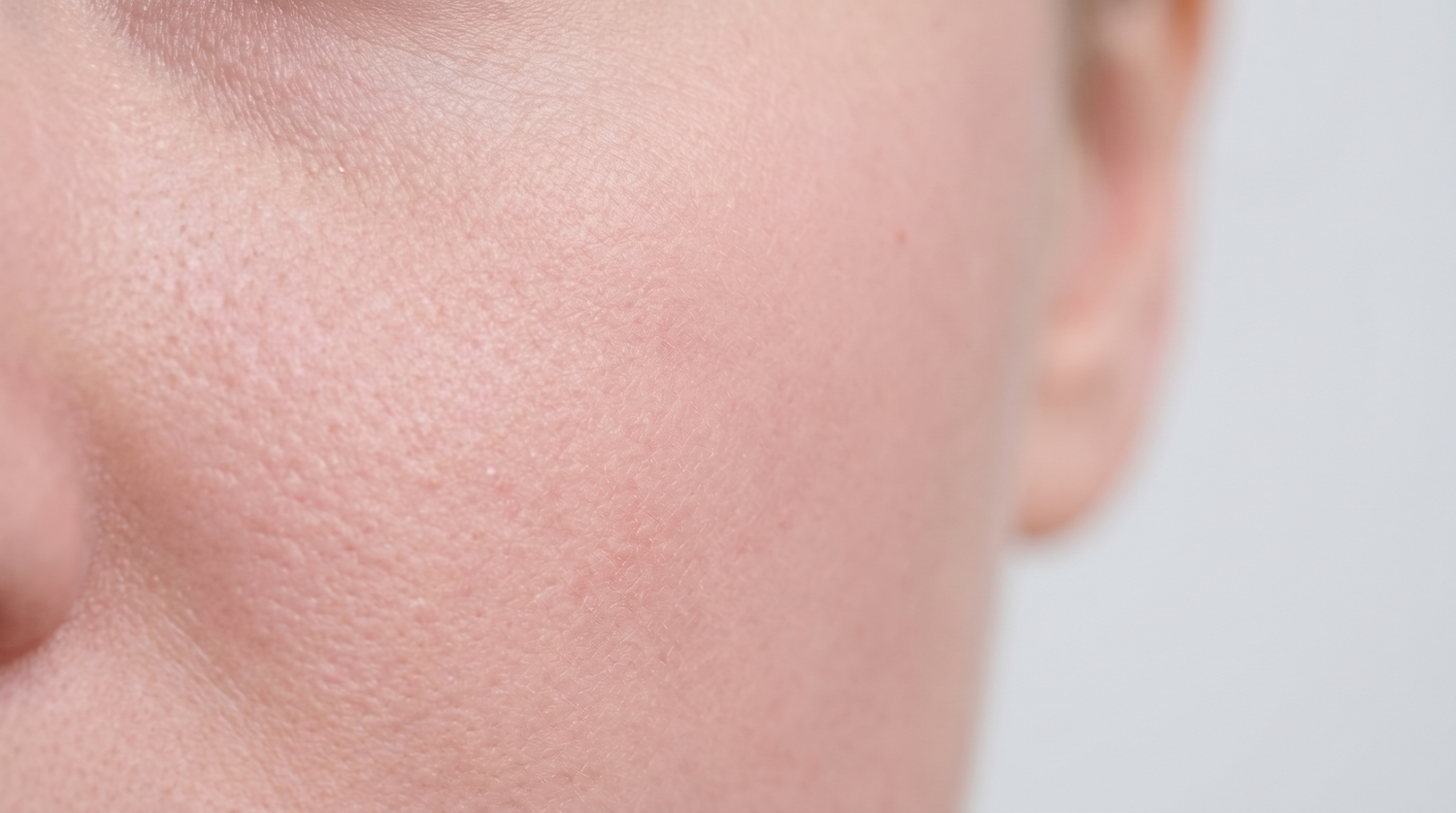 Primo piano di pelle post-procedura con lieve rossore uniforme, skincare clinica Remodermis